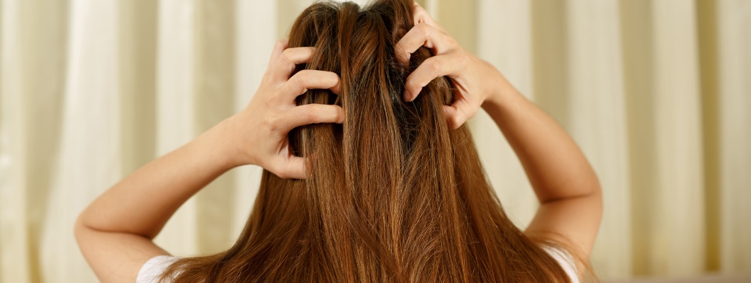 Cum să menții un scalp sănătos și să eviți mâncărimea?