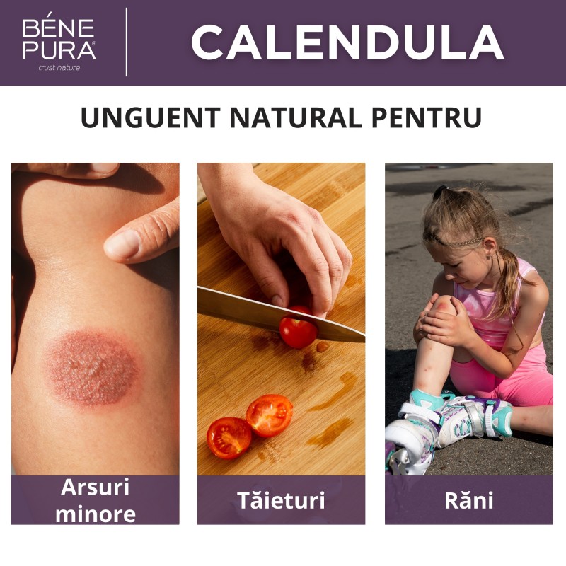 Set Unguente pentru Răni, Arsuri și Mâncărime 2