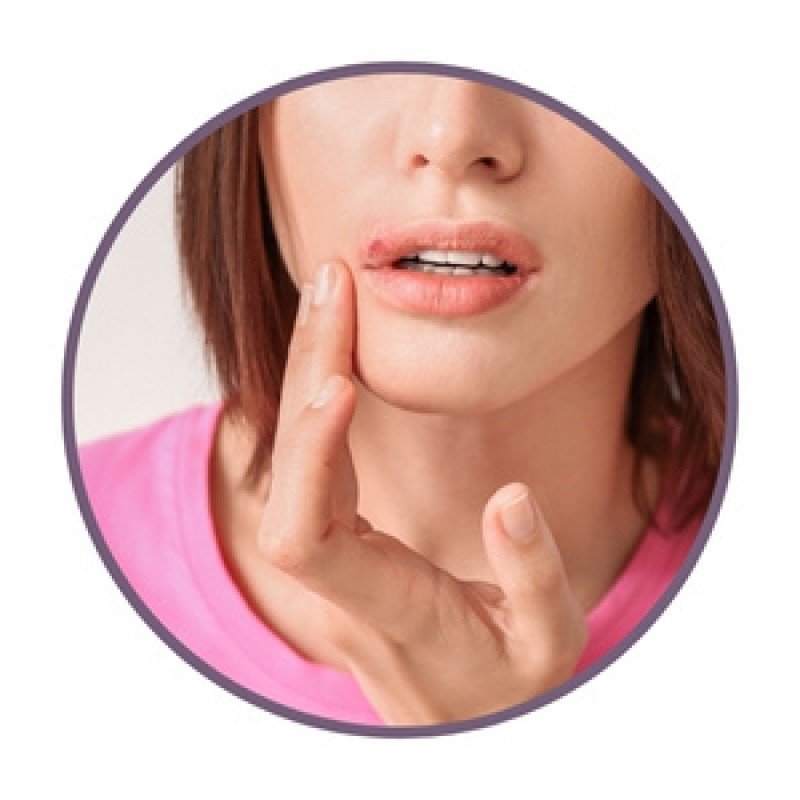 Unguente pentru herpes labial