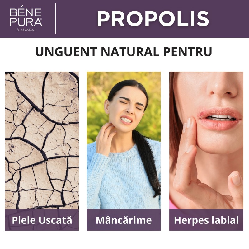 Unguent Pentru Anti Mancarimi cu 30% Propolis - 40ml