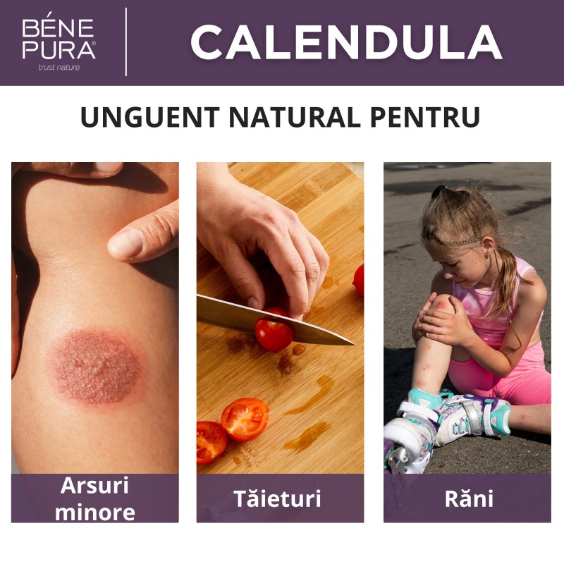 Unguent pentru Arsuri și Răni cu Gălbenele - 40ml