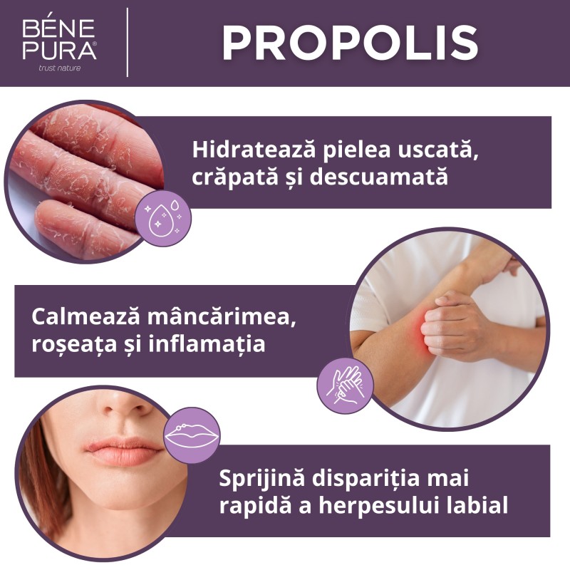 Unguent Pentru Anti Mancarimi cu 30% Propolis - 40ml