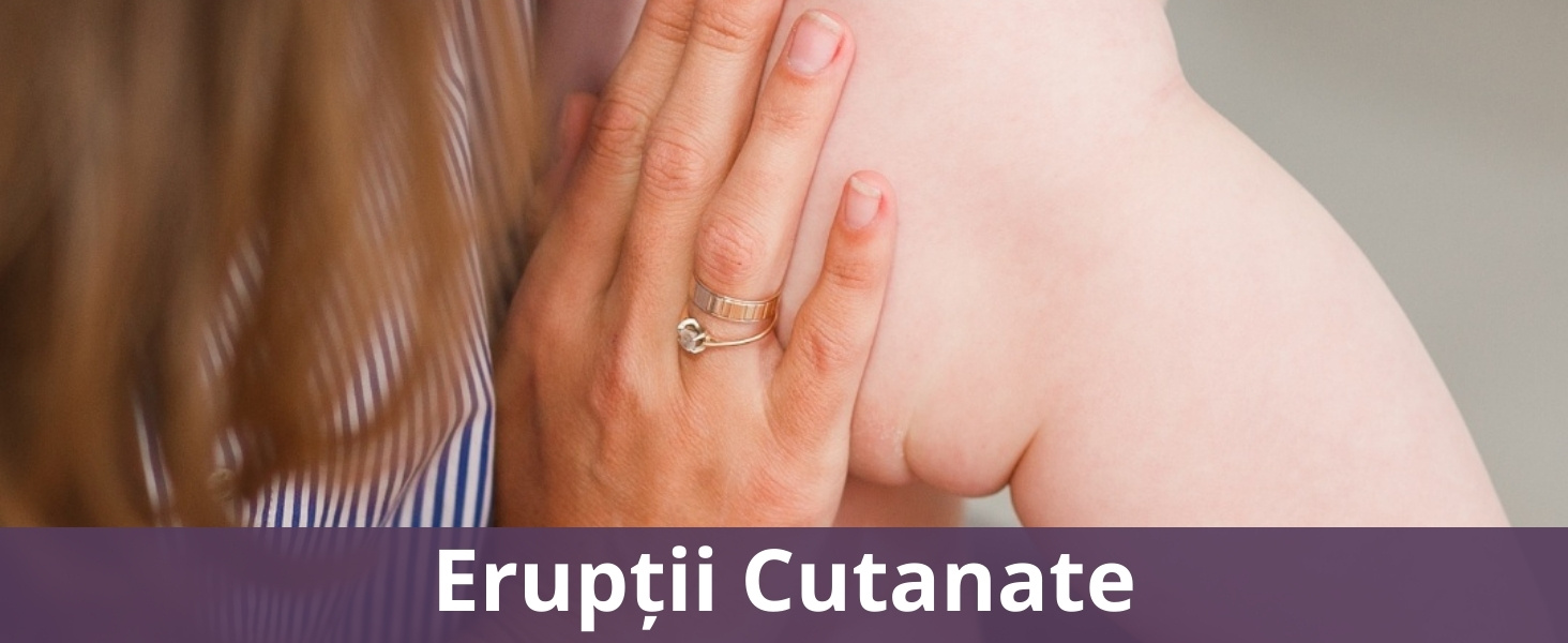 Erupții Cutanate