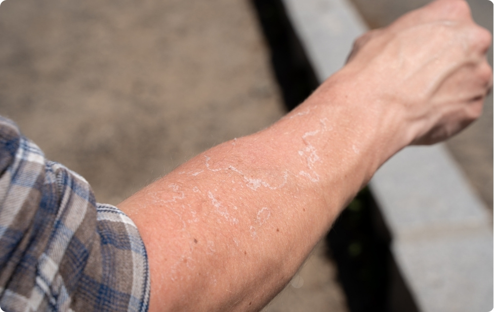 Ca ulei pentru pielea iritată și uscată