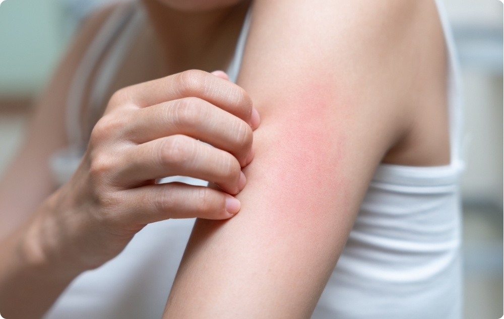 Ca ulei pentru cicatrici și după iritații